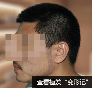 32岁国先生植出钟爱络腮胡