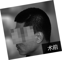 32岁国先生植出钟爱络腮胡