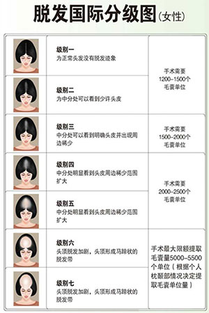 儿童植发,疤痕植发