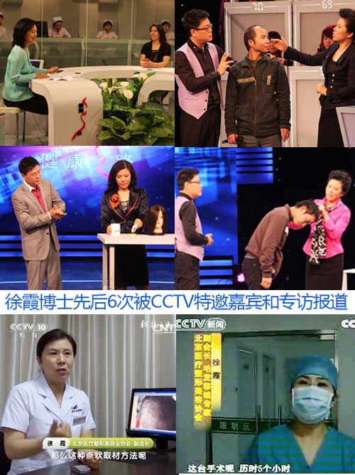 头发种植,脱发