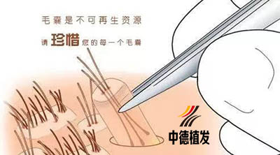 中德植发,