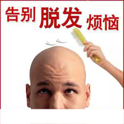 脂溢性脱发,