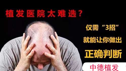 植发医院,