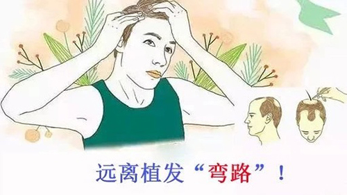 中德植发,徐