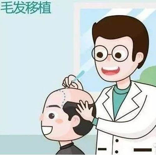 夏季植发,
