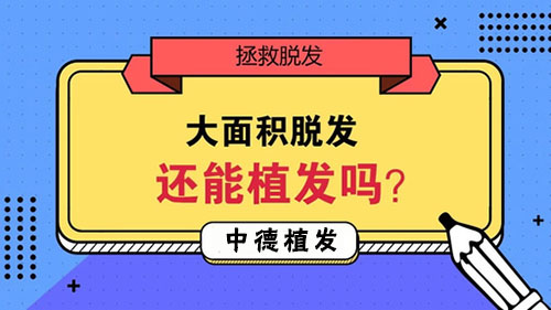 植发,