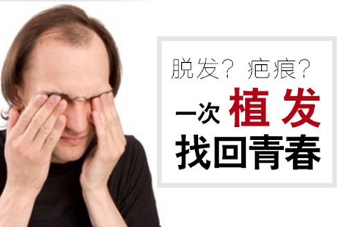 植发,