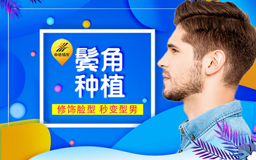 鬓角移植,
