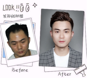 乌黑浓密的秀发,