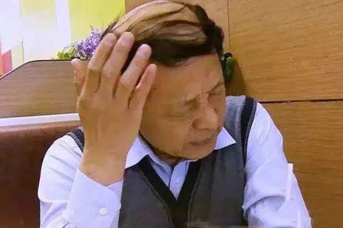 植发医院哪家好,