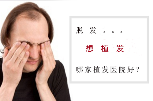 哪家植发医院好,