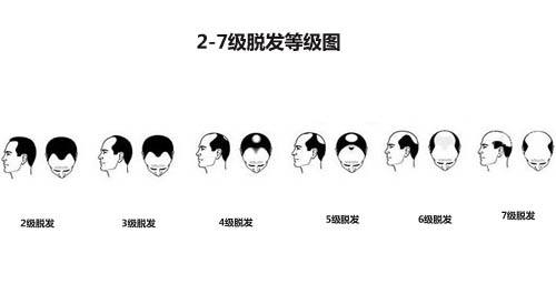 中德植发,徐霞,