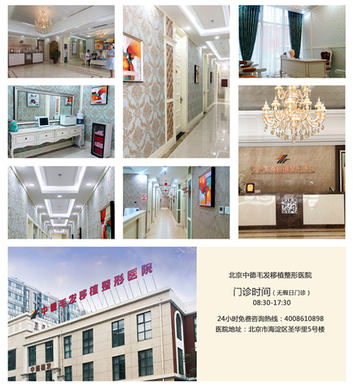毛发移植医院哪家好,