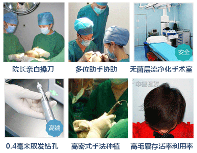 毛发移植医院哪家好,