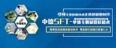 中德SFT,