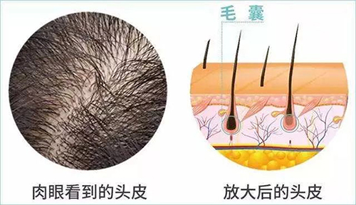 徐霞,掉发严重,