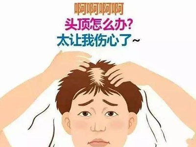 发际线调整,