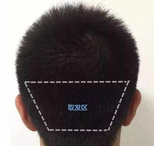 徐霞,毛囊,