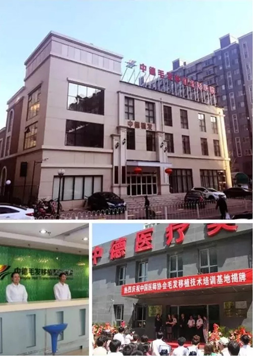 植发,