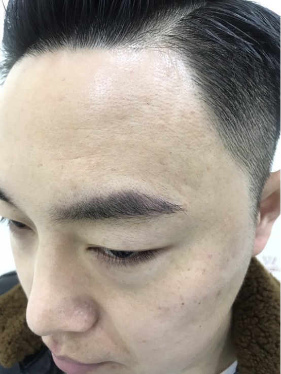 眉毛稀少,