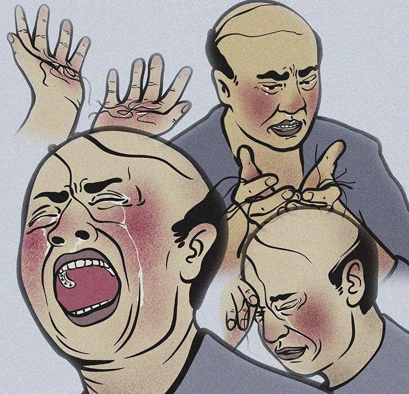 徐霞,脱发,