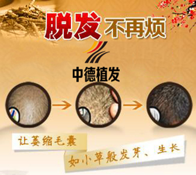 中德植发,