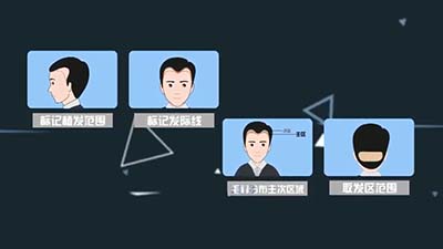 头皮总是出油怎么回事